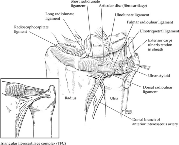 What Is A TFCC Tear Of The Wrist? | Sydney Physio Clinic