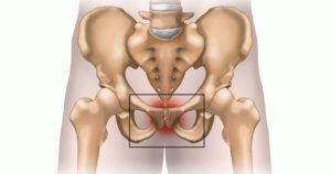 Treatment For Osteitis Pubis